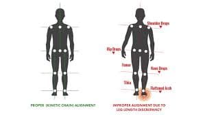 Side Effects of Wearing a Walking Boot